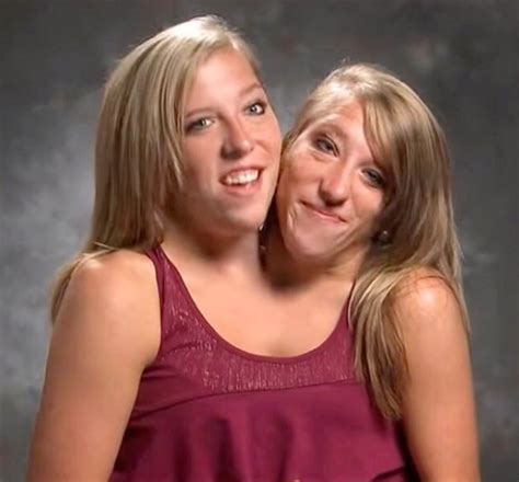 What conjoined twins Abby and Brittany have said about having a baby ...