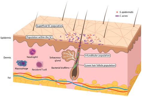 JCM | Free Full-Text | Potential Role of the Microbiome in Acne: A Comprehensive Review