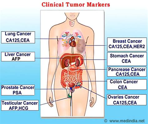 Tumor Markers - For Cancer Diagnosis and Prognosis