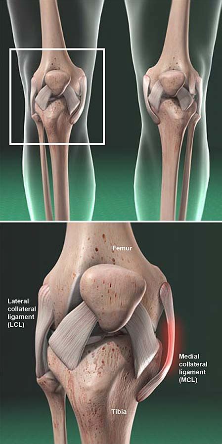 Tibial Collateral Ligament