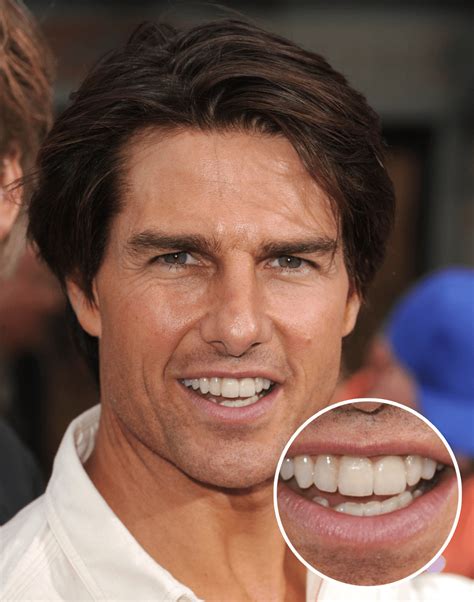 Tom Cruise Teeth Before And After Braces - Did Tom Cruise Start His ...