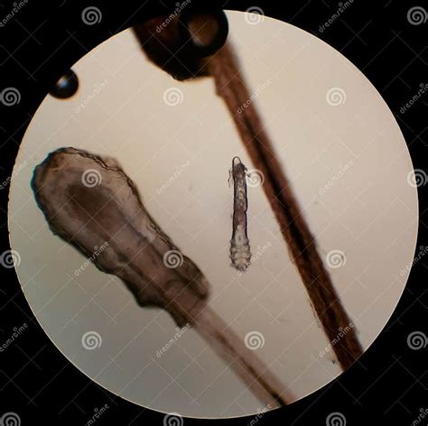 Demodex Folliculorum - Parasitic Mite on the Eyelashes of a Human Eye ...