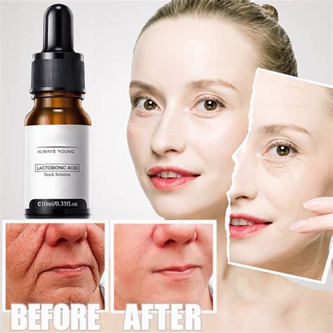 🔥Buy 1 Get 1 Free--Instant Perfection Serum【Buy More Save More】 in 2021 ...