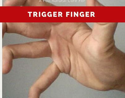 Trigger Finger Surgery Projects | Photos, videos, logos, illustrations ...