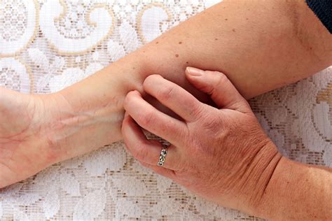 Understanding and Managing Itchy Skin in Older Adults: Causes and ...