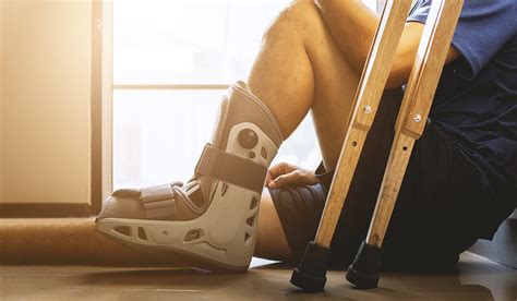 Busted Ankle? What's Better, a Cast or Brace? - Comprehensive Orthopaedics