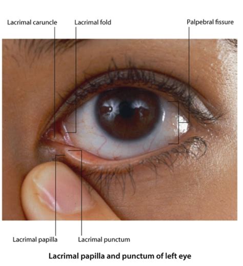 Lacrimal Punctum