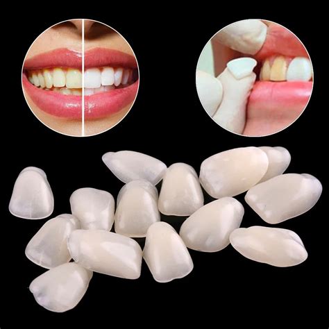 70Pc/Pack Dental Teeth Veneers Ultra Thin Whitening Resin Anterior Upper Temporary Crown ...