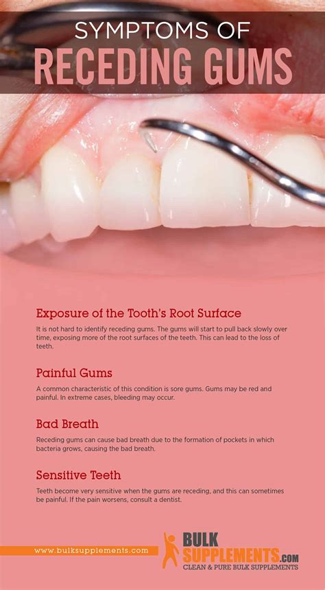 Tablo | Read 'Receding Gums: Symptoms, Causes & Treatment' by