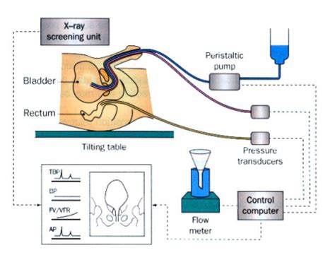 Melbourne Bladder Clinic | Urodynamics (Bladder Pressure Study)