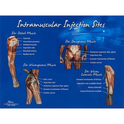 Intramuscular Injection Sites Chart – Nasco Healthcare