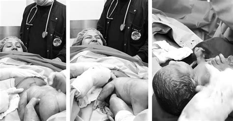 Must watch: Amazing c-section breech birth video captures bottom-first ...