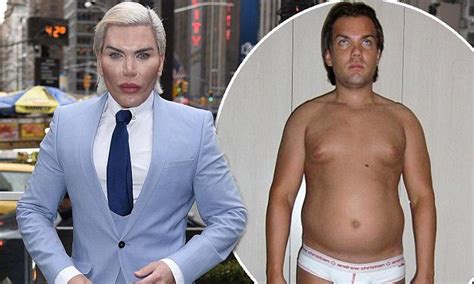 Human Ken Doll Rodrigo Alves says no more plastic surgery | Plastic surgery, Plastic surgery ...