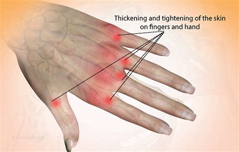 Health Condition : Symptoms, Causes, Treatment and More