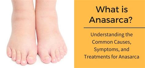 What is Anasarca? Understand the Causes, Symptoms & Treatments