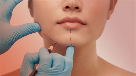 Experts Predict the Biggest Plastic Surgery Trends for 2023 | Allure