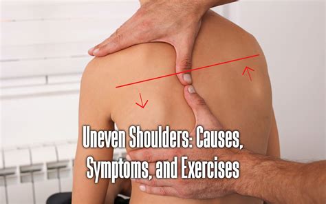 Uneven Shoulders: Causes, Symptoms, and Exercises