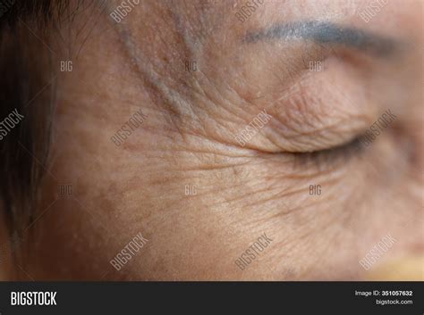 Wrinkled Skin Texture