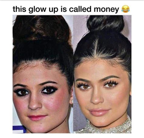 Kylie Jenner Lips Money Meme Glow Up Haha