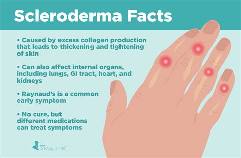 What is Scleroderma? Understanding Symptoms, Causes, and Treatments