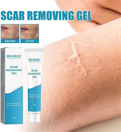 Waitlover Scar Removal Cream Gel - 20g | Repairs Pock Marks, Burns ...