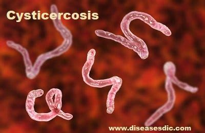 Cysticercosis – Transmission, Diagnosis, and Prevention