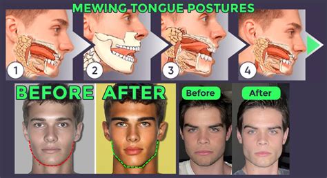 Body Fat Percentage Affects Jawline: Here Is How | Mewing.coach