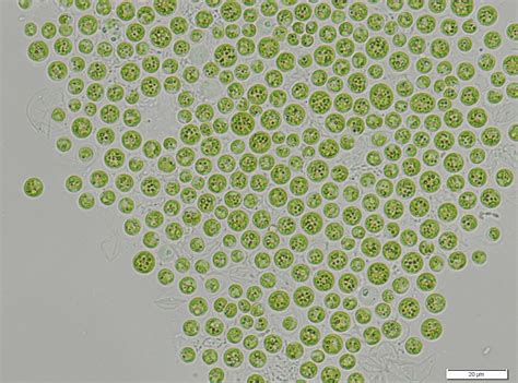 CyanoRO - a page dedicated to Romanian Cyanobacteria : Microcystis aeruginosa from Danube Delta ...