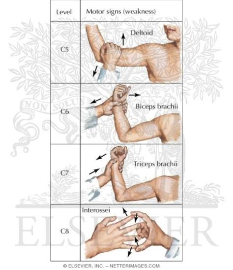 Manual Muscle Testing of the Upper Limb