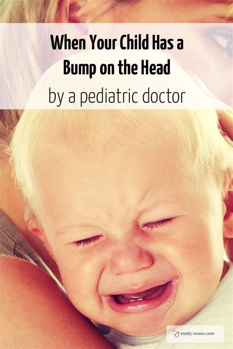 A Bump on the Head | Baby bumped head, Pediatrics, Parent child relationship