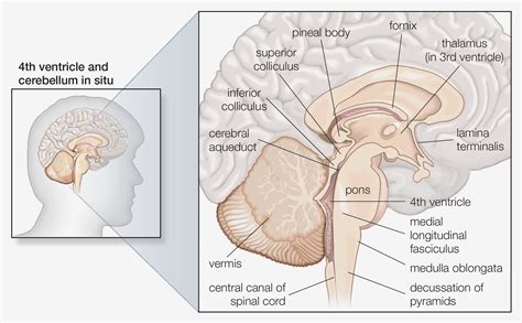 What to Expect From a Stroke of the Medulla Oblongata