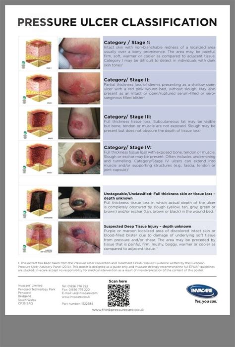 Pin by Millie R. Ragsdale on Nurse | Surgical nursing, Medical surgical nursing, Pressure ulcer