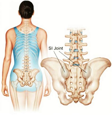 SI Joint hip osteopathic | DW Osteopathy | Chepstow & Cardiff Osteopath