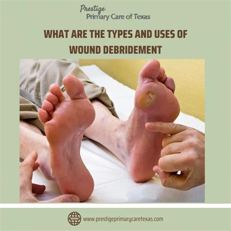 What Are The Types and Uses of Wound Debridement – Dallas, TX ...