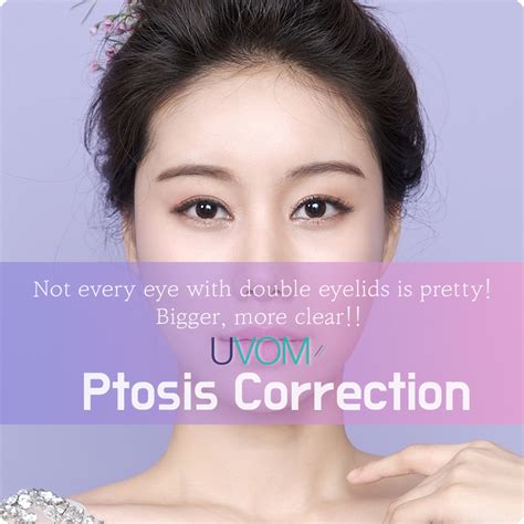 UVOM Plastic Surgery Korea Double Eyelid Surgery Ptosis Correction Surgery Experience
