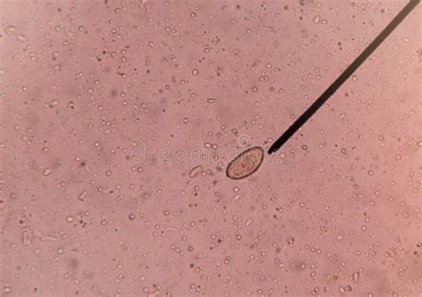 Parasite Eggs In Poop