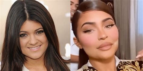 KUWTK: Why Twitter Can't Stop Talking About Kylie Jenner's Cheeks