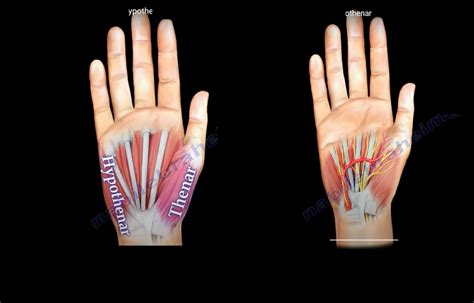 Thenar and Hypothenar Muscles of the Hand — OrthopaedicPrinciples.com