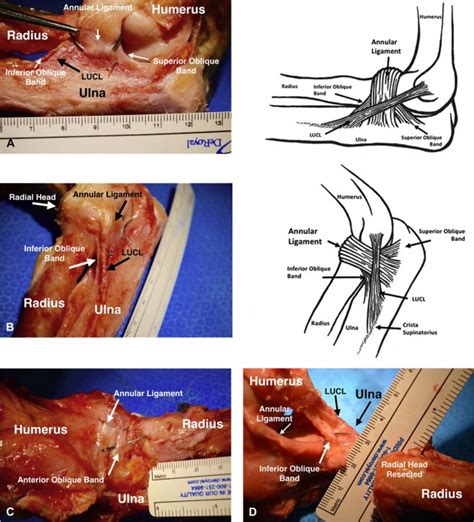 The annular ligament—revisited - Journal of Shoulder and Elbow Surgery