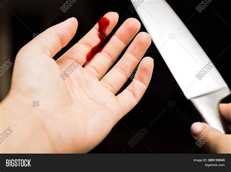Finger Cut By Knife