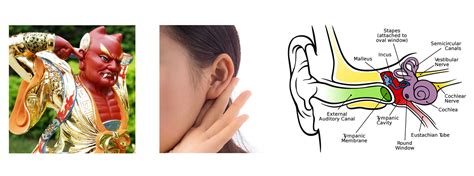 Cochlear Implant Magnets - SDM Magnetics Co., Ltd.