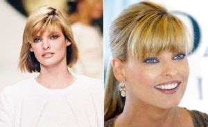 Linda Evangelista Before and After Plastic Surgery: Face, Body