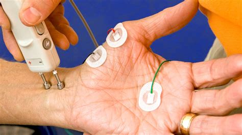 Electromyography (EMG): Uses, Preparation, Test Results