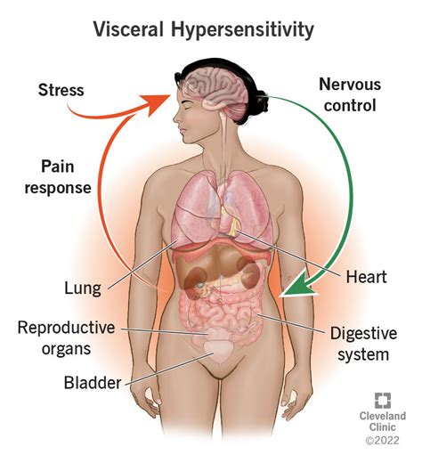 Visceral Hypersensitivity: Symptoms, Treatment, Causes & What it Is