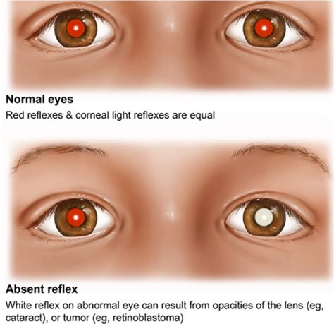 Pediatric Exam Flashcards | Quizlet