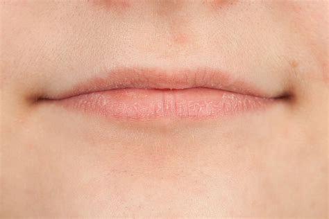 White Spots On Lips After Sunburn | Lipstutorial.org