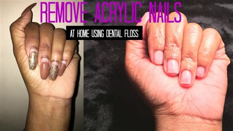 Easy How To Remove Acrylic Nails Using Dental Floss (At Home) - Dental Clinic
