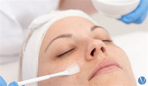 Chemical Peel Aftercare Guide | Vujevich Dermatology Associates