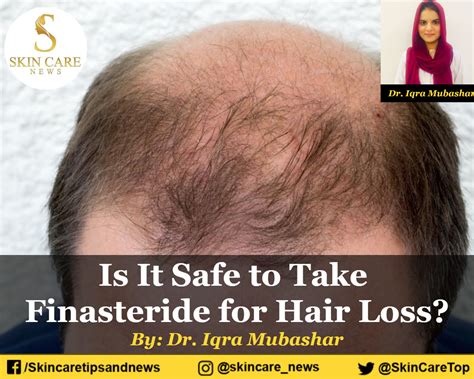 Is It Safe to Take Finasteride for Hair Loss?