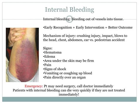 PPT - Shock and Bleeding in the Trauma Patient PowerPoint Presentation - ID:1873230